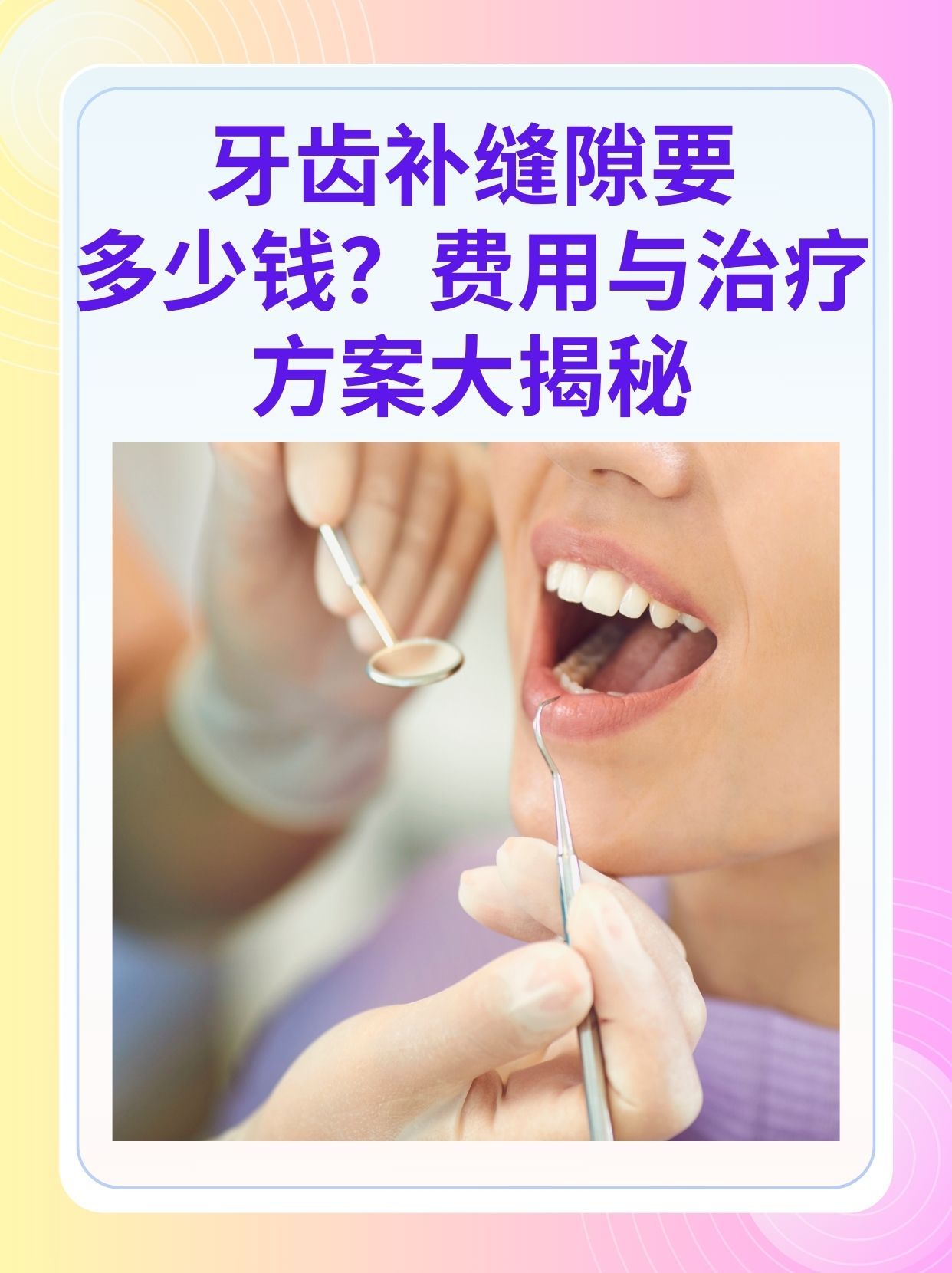 三亚补牙医保可以报销吗(补牙医保可以报销吗 哪些可以报销呢)